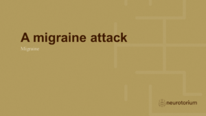 A migraine attack
