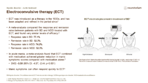 Electroconvulsive therapy (ECT)