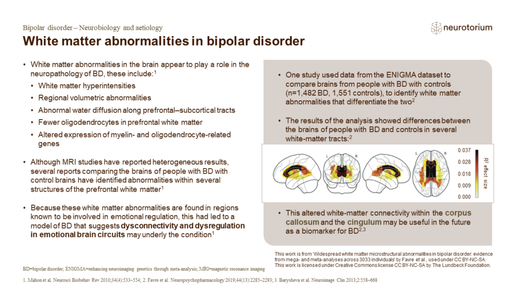 White matter abnormalities in bipolar disorder