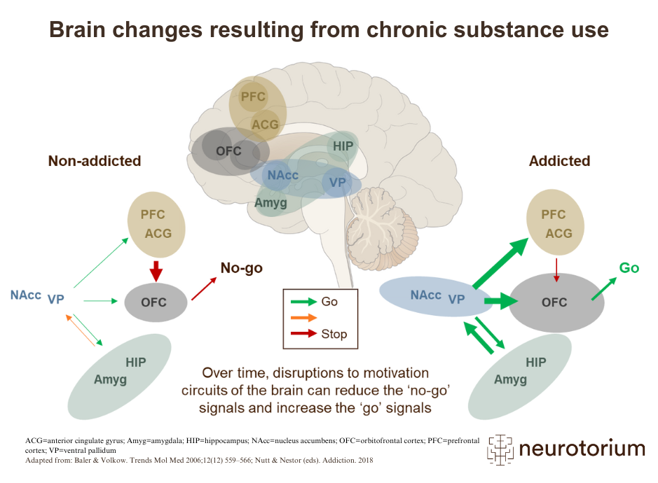 Brain changes resulting from chronic substance use
