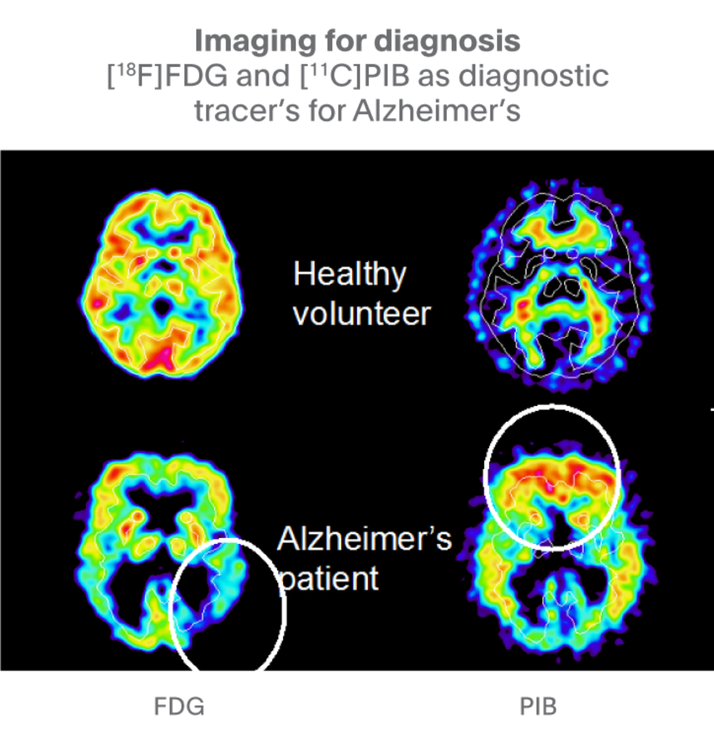 Imaging for diagnosis