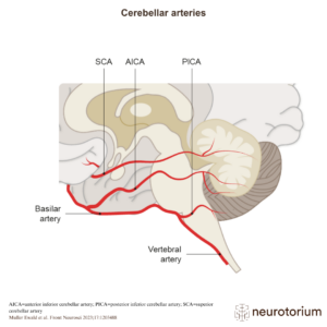 The cerebellum is supplied with blood via three branches of the basilar artery – the posterior inferior cerebellar artery (PICA), the anterior inferior cerebellar artery (AICA), and the superior cerebellar artery (SCA).