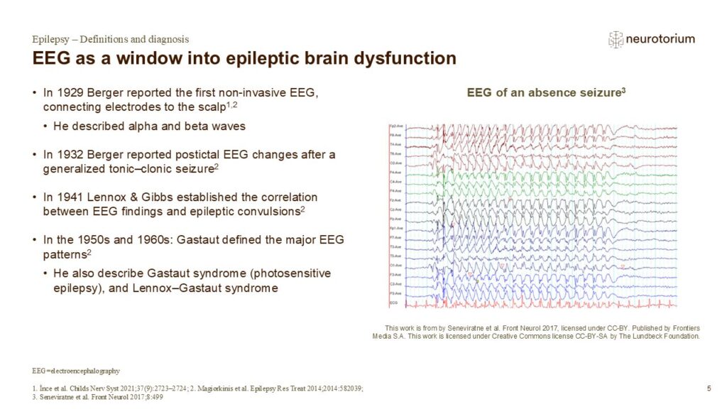 EEG as a window into epileptic brain dysfunction