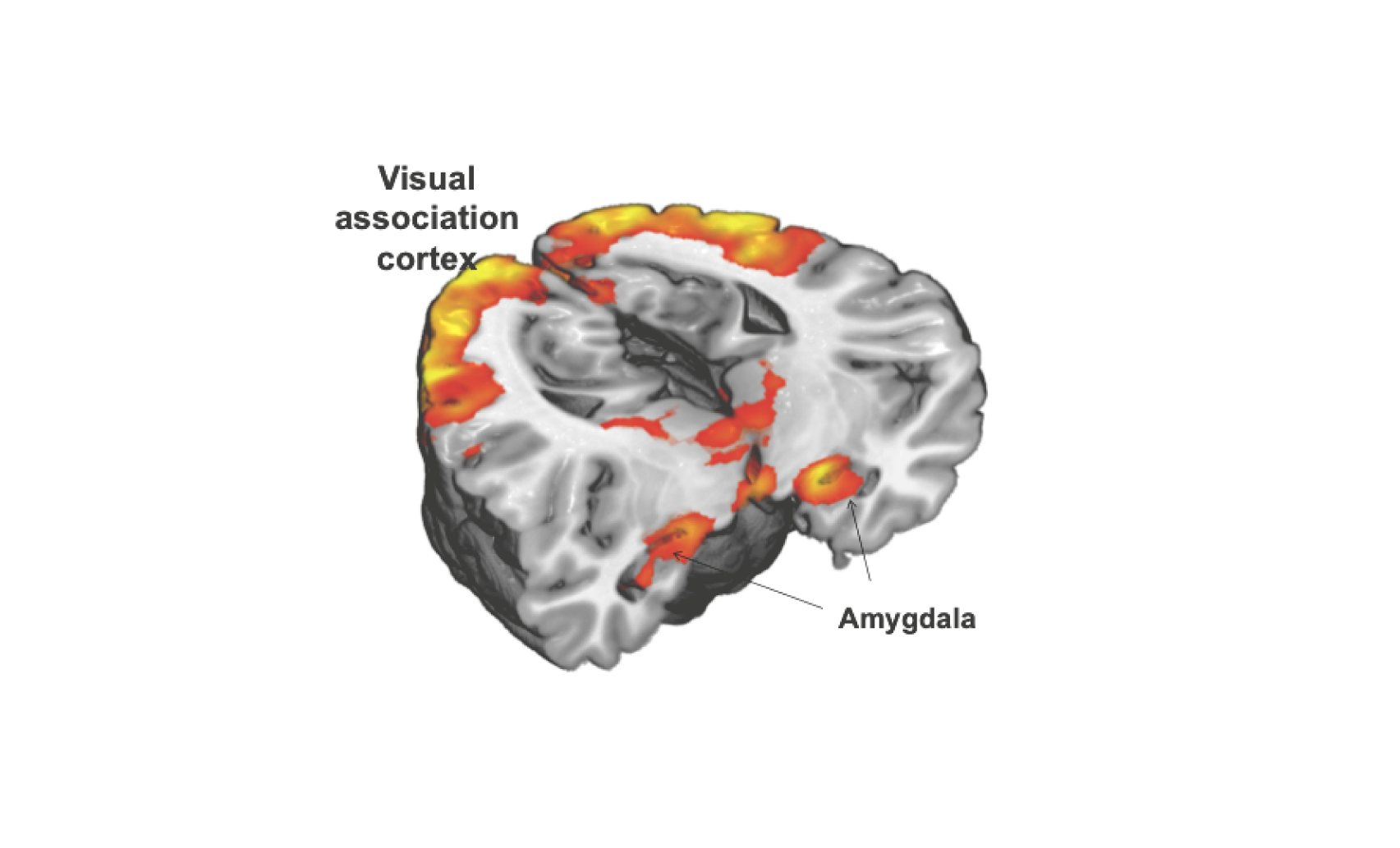 *add new title - Amygdala and visual association cortex