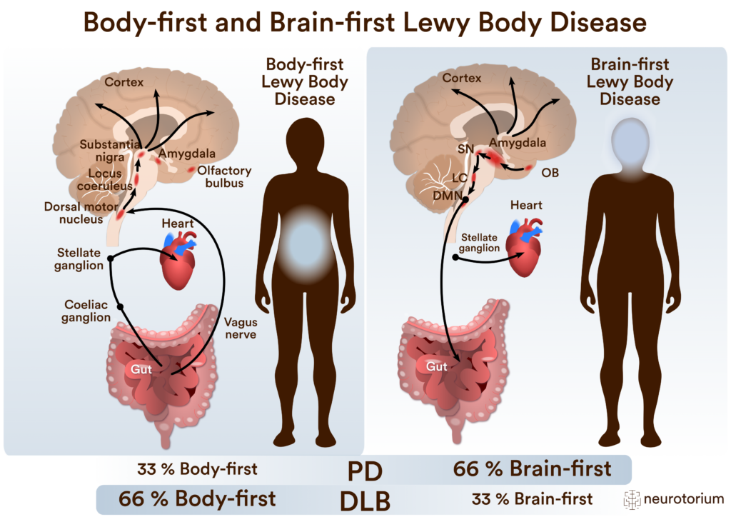 Parkinson's Disease and Braak stages - Neurotorium