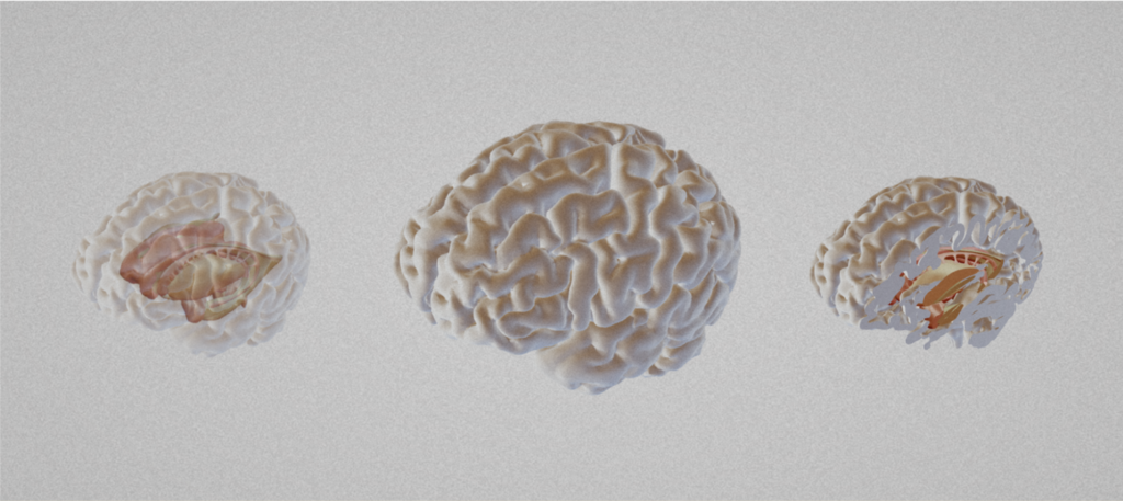 This picture illustrates the 3D Brain Atlas at Neurotorium.org.