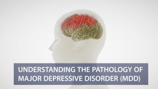 Understanding Disease Pathology of Major Depressive Disorders