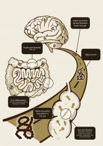 Schematic illustration of how the gut-brain axis may contribute to the spread of alpha-synuclein pathology