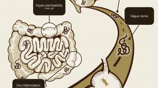The microbiome-gut-brain axis
