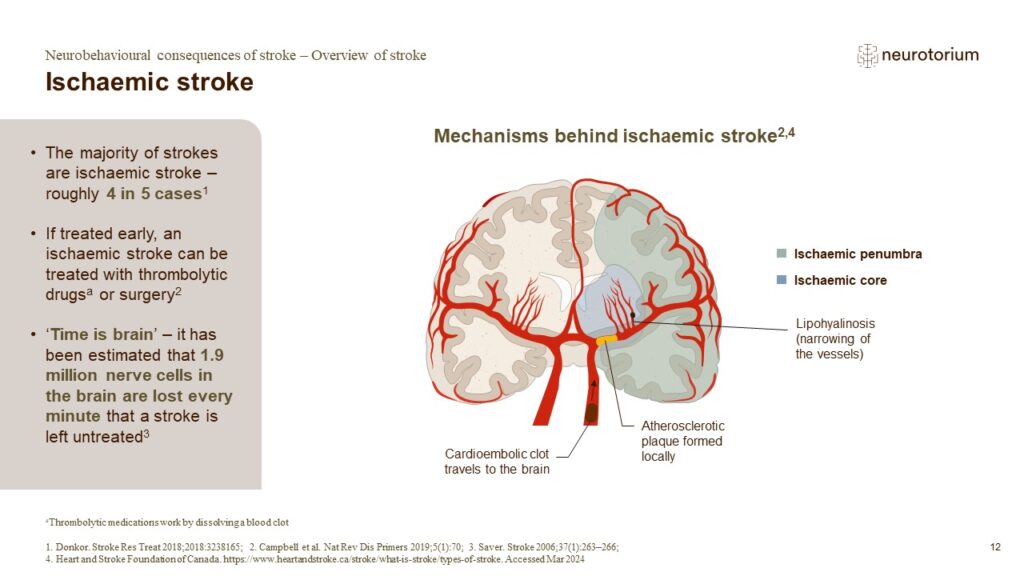 Ischaemic stroke