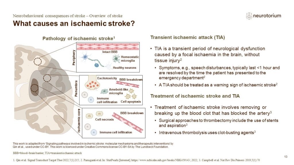What causes an ischaemic stroke?