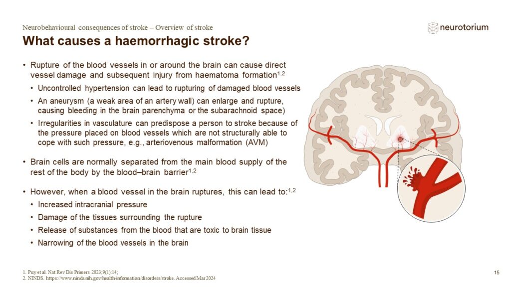 What causes a haemorrhagic stroke?