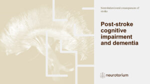 Post-stroke cognitive impairment and dementia