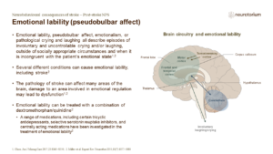 Emotional lability (pseudobulbar affect)