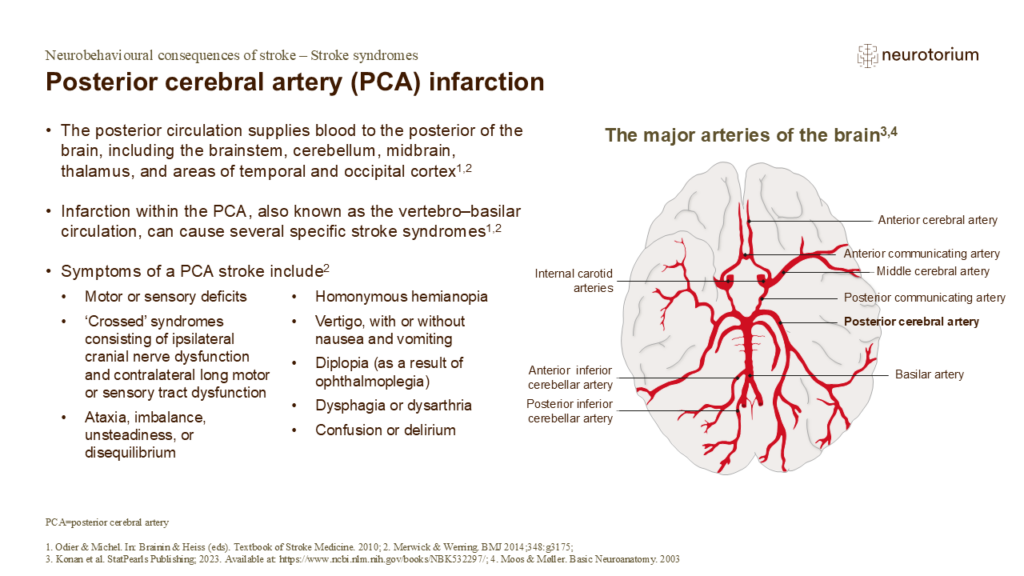 Posterior cerebral artery (PCA) infarction