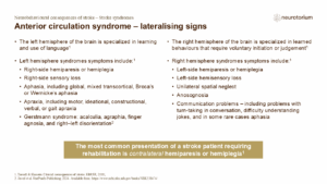 Anterior circulation syndrome – lateralising signs