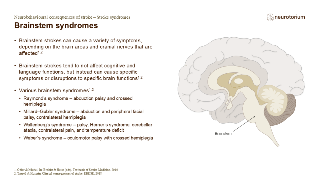 Brainstem syndromes