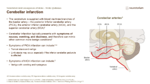 Cerebellar infarction