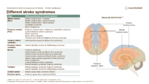 Different stroke syndromes