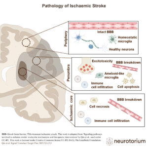 The pathology of ischaemic stroke is complex, but commonly involves the formation of a clot that travels in the blood to or within the brain and becomes lodged in the blood vessels of the brain (a thromboembolism), which can reduce or block blood flow (an occlusion).
