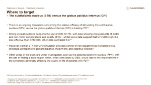 Where to target – The subthalamic nucleus (STN) versus the globus pallidus internus (GPi)
